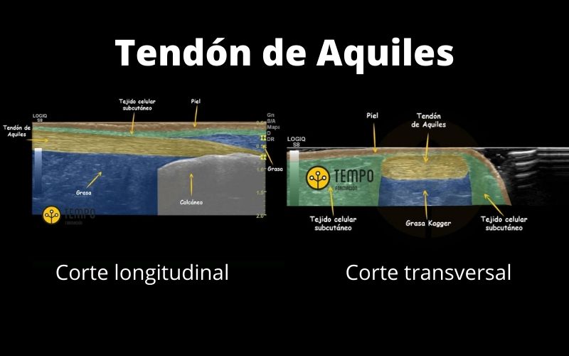 Anatomia Ecografica.jpg